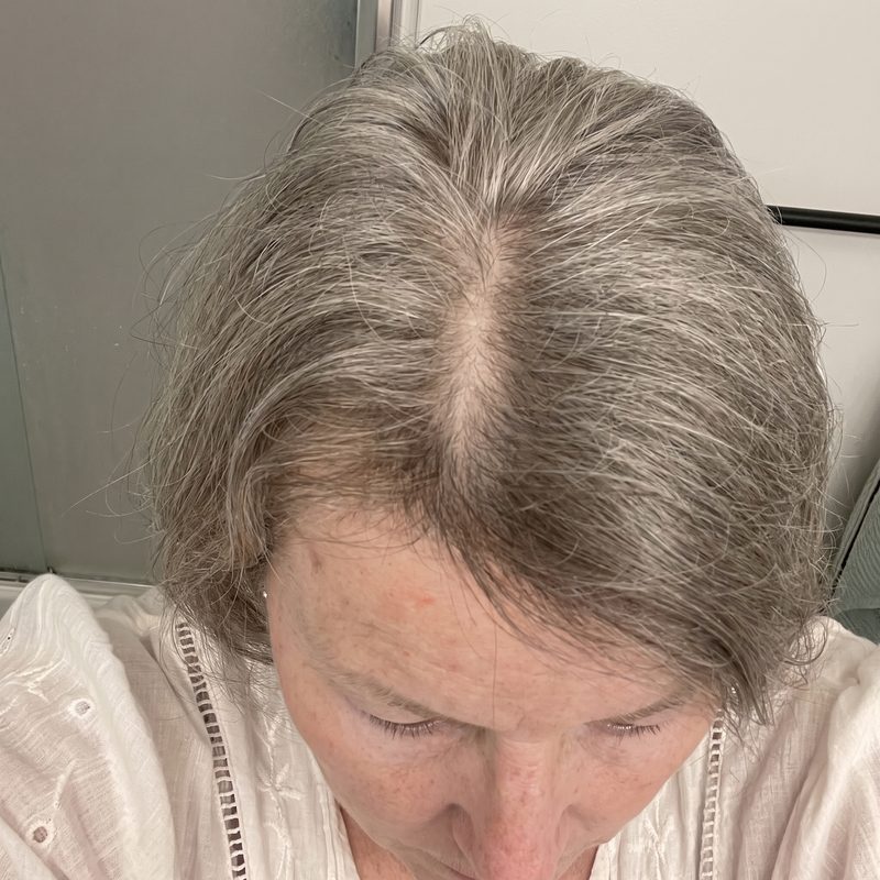 Megan C.&rsquo;s new growth along her part