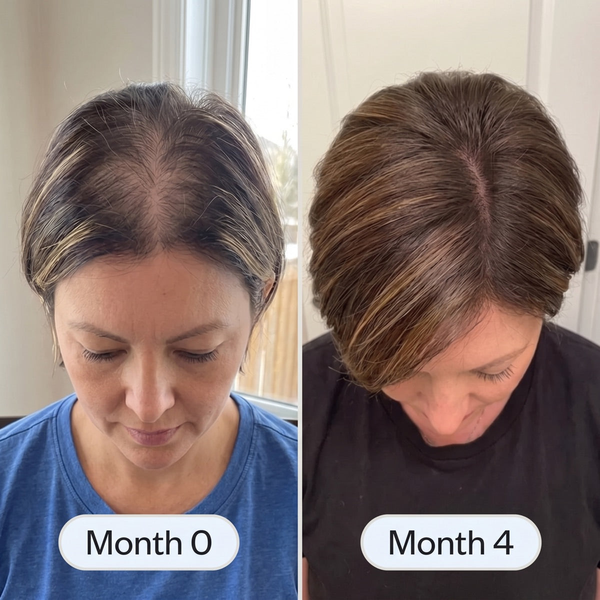 Before and after: her crown