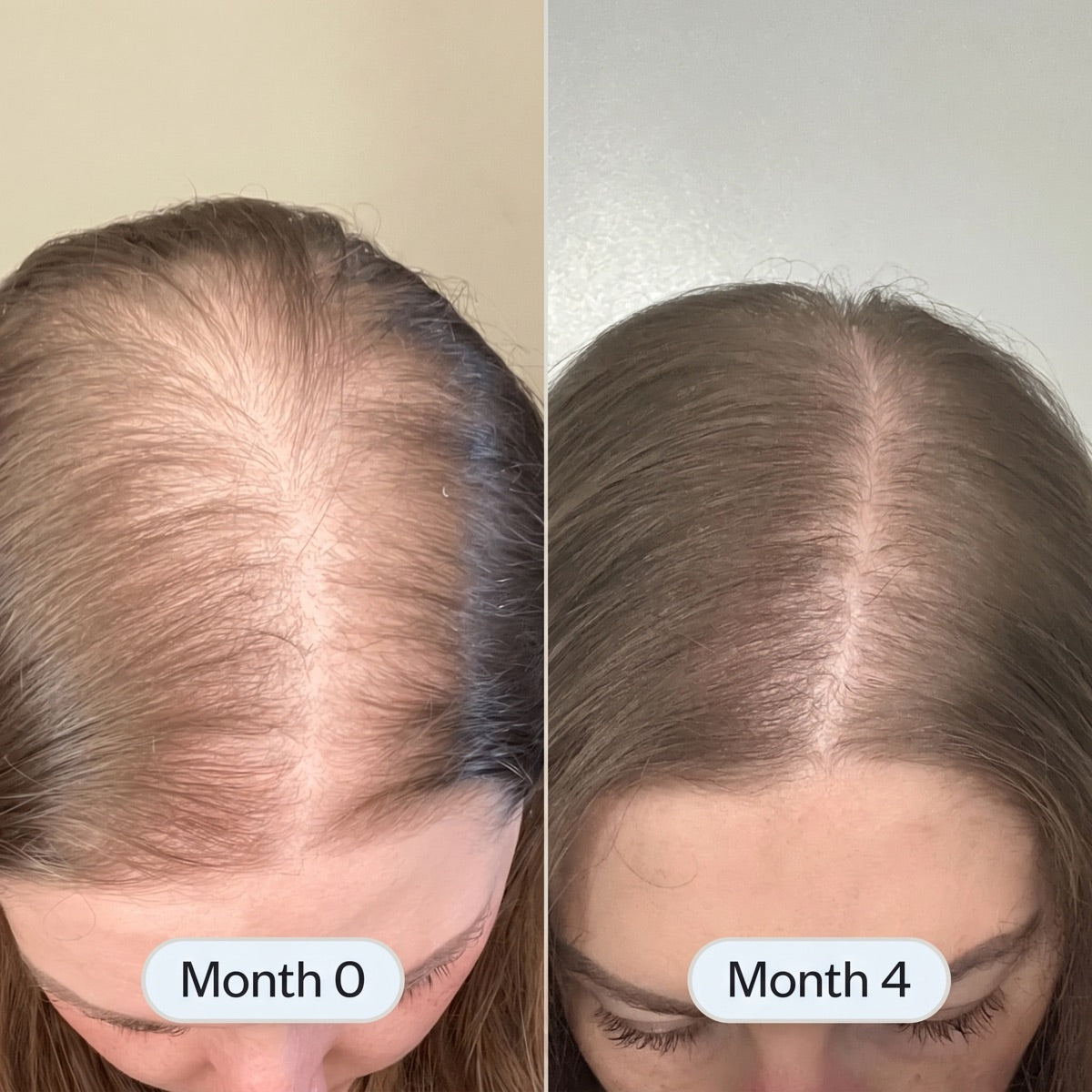 Before and after: her part line, month 0 to month 4